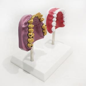 Modelo Comparativo de Dientes de Fumador, Modelo de Exhibición de <span class=keywords><strong>Salud</strong></span> Bucal, Modelo Educativo de Anatomía Dental - Product Image 1