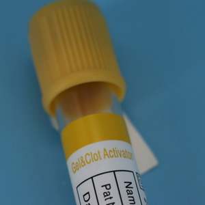 दांतों के लिए स्टेल जेल क्लॉट सक्रियरेटर सेस्ट वैक्यूम रक्त नमूना संग्रह ट्यूब - Product Image 5