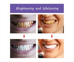 ยาสีฟันเพื่อฟันขาวฟันขาวฟันเหลือง - Product Image 2