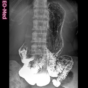 Appareil de radiographie numérique dynamique avec système de fluoroscopie - Product Image 4