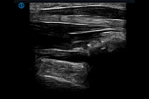 SIUI VP2 Phased/ Linear/Convex Handheld Veterinary Ultrasound Scanner and Portable Color Doppler Veterinary Imaging System - Product Image 5
