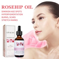 Minyak pinggul mawar Perawatan Kulit Label pribadi minyak Rosehip organik tekanan dingin tidak dimurnikan
