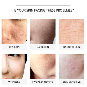 Exfoliante Corporal de Café Orgánico Natural con Manteca de Karité y Coco, Tratamiento para el Acné y las Estrías - Product Image 5