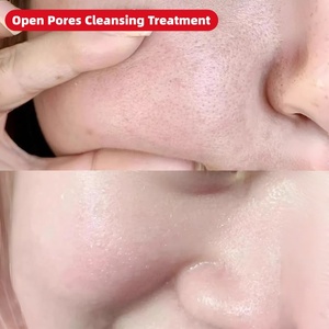 Traitement Nettoyant en Gros pour Pores Dilatés, Peeling Enzymatique Lissant pour la Peau, Exfoliant Facial, Effaceur Instantané de Pores, Lotion Contrôle du Sébum - Product Image 2