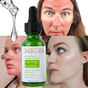 Suero de té verde orgánico Mruis, suero antiacné, tratamiento de espinillas, suero de control de Aceite hidratante antioxidante brillante - Product Image 4