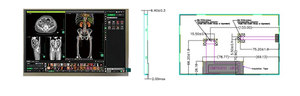 จอแสดงผล LCD ขนาด 8 นิ้ว 1280×720 ทนอุณหภูมิสูง LVDS -30 ° ซีถึง 85 ° หน้าจอแสดงผล C High Brightness 800nits IPS TFT LCD - Product Image 2