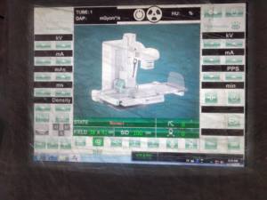 医療用高周波デジタルX線撮影機80kW10-1000mA X線撮影機価格 - Product Image 6