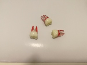 Tự Nhiên Giải Phẫu Gốc Hình Thức Mô Hình Răng Với Bột Giấy Khoang Vật Liệu Nhự<span class=keywords><strong>a</strong></span> Cho Endodontic Đào Tạo Chăm Sóc Răng Miệng - Product Image 4