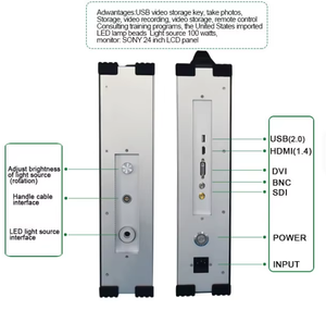 चिकित्सा उपकरण HD लैप्रोस्कोपिक एंडोस्कोप कैमरा लैप्रोस्कोपी पोर्टेबल एंडोस्कोप सिस्टम - Product Image 2