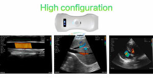 MC26 image la plus claire 192 éléments 3 en 1 sonde à ultrasons sans fil <span class=keywords><strong>usg</strong></span> pour la tyroïde, la grossesse, le cœur - Product Image 4