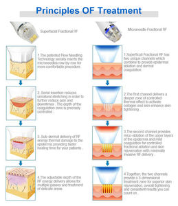 Cartouches de <span class=keywords><strong>micro</strong></span>-<span class=keywords><strong>aiguilles</strong></span> fractionnelles RF en or pour le visage, traitement de la peau, pointe isolée, 64 broches, 24 broches, 10 broches, nano-puces - Product Image 4