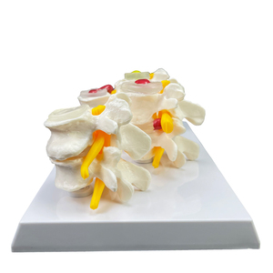 Dégénérescence des vertèbres lombaires Modèle de squelette humain - Product Image 6