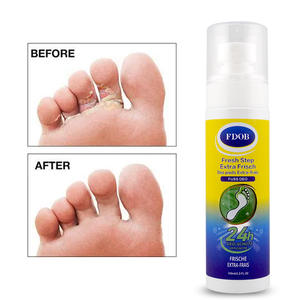 Spray cómodo para el talón y la suela de alta calidad, cuidado de los pies, spray antihongos, paso fresco, 100ml para la sequedad y la piel agrietada - Product Image 3