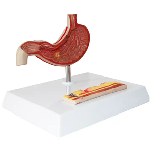 Equipo de enseñanza médica, ciencia médica, modelo de órgano humano patológico gástrico, modelo de anatomía, modelo de estómago - Product Image 2