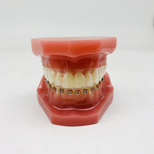 แบบจำลองทางทันตกรรมสำหรับการวิจัยทางทันตกรรมรูปแบบการรักษาทันตกรรมจัดฟัน - Product Image 1