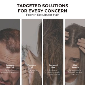 Kit de Soins Capillaires à l'Oignon Rouge pour Cuir Chevelu Irrité, Traitement Naturel <span class=keywords><strong>Anti</strong></span>-<span class=keywords><strong>Chute</strong></span> et Favorisant la Croissance, Marque Privée, Shampoing et Après-Shampoing - Product Image 2