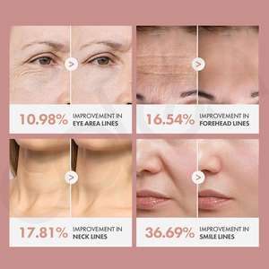 Stick de baume au collagène anti-âge Luxfume Private Label pour repulper les <span class=keywords><strong>rides</strong></span> sur les yeux, les lèvres et le visage pour une peau éclatante - Product Image 5