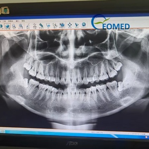 Système de radiographie céphalométrique numérique d'occasion robuste à numérisation rapide pour diagnostic panoramique oral en milieu hospitalier dentaire - Product Image 2