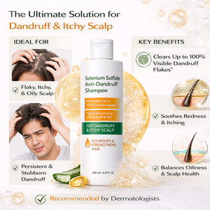 Shampoo antifongique antipelliculaire pour cuir chevelu sec et irrité, traitement du cuir chevelu pour pellicules légères à sévères, soulagement des pellicules - Product Image 5