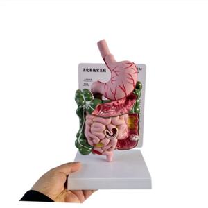 แบบจำลองทางกายวิภาคของระบบย่อยอาหารมนุษย์ที่ทำจากพีวีซี แสดงโรคทางพยาธิวิทยาในลำไส้ใหญ่ - Product Image 3