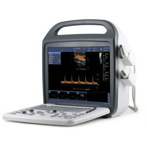 Mesin Pemindai <span class=keywords><strong>Ultrasound</strong></span> Laptop Portabel Penyimpanan Besar Layar Besar Mesin <span class=keywords><strong>Ultrasound</strong></span> Doppler Warna untuk Sapi - Product Image 4