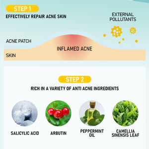 Patchs de boutons hydrocolloïdes Zit Blemish Acne Dots Sticker <span class=keywords><strong>Patch</strong></span> de boutons <span class=keywords><strong>anti</strong></span>-acné - Product Image 5