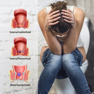 Extrato Herbal de 30g Mais Vendido para Alívio de Hemorroidas e Fissuras Anais. Creme para Alívio de Hemorroidas e Fissuras Anais - Product Image 5