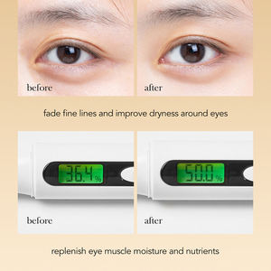 Crema Contorno de Ojos Ball Eye, Cuidado de la Piel Transfronterizo, Gel Antiarrugas, Ilumina el Tono Facial, con Infusión de Aceite, Belleza - Product Image 5