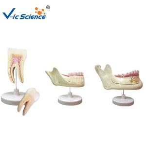Modèle éducatif d'anatomie dentaire <span class=keywords><strong>mandibulaire</strong></span> Modèle de dents caduques et permanentes - Product Image 2
