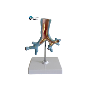 Modelo de Enseñanza Médica, Modelo de Anatomía Patológica de las Bronquias para la Educación en Medicina Respiratoria y Pulmonología - Product Image 1