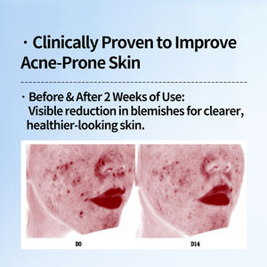 Limpiador <span class=keywords><strong>facial</strong></span> Pioning Oily Skin, espuma eficaz para el tratamiento del acné para el control del aceite y la exfoliación para mujeres y adultos - Product Image 5