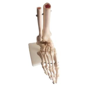 Modello Anatomico del Piede e della Caviglia Umani a Grandezza Naturale 1:1 con Base per Insegnamento Medico - Product Image 4