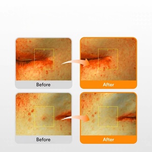 Sérum anti-taches Abiib au pamplemousse et <span class=keywords><strong>glutathion</strong></span>, essence liquide à la vitamine C - Améliore les problèmes de taches et de taches brunes - 50 ml - Product Image 6