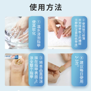 تعكر سطح الأظافر الناعمة خلع الأظافر كريم مضاد للفطريات للأظافر الرمادية - Product Image 3