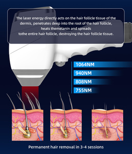 Macchina per Epilazione Laser a Diodi AI per Medicina Estetica, Schermo Touch, Raffreddamento ad Aria/Acqua per Viso/Corpo, Uso Domestico e Commerciale - Product Image 5