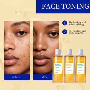 OEM/ODM Tonique éclaircissant à la niacinamide pour peaux abîmées, soin de la peau hydratant en profondeur, réparation douce <span class=keywords><strong>anti</strong></span>-rougeurs, amélioration des imperfections - Product Image 2