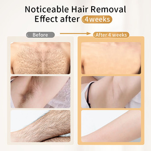 Dispositivo de depilación láser IPL portátil Moolweel T003, superventas, herramienta de belleza portátil, <span class=keywords><strong>depiladora</strong></span> de hielo <span class=keywords><strong>Soprano</strong></span> con tecnología ABS para el hogar - Product Image 4