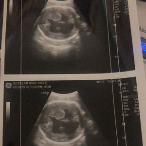 Pemindaian medis lebar A6 UPP-110S UPP-110HG Video hitam dan putih kertas Film Ultrasound termal Media kertas kasir - Product Image 5