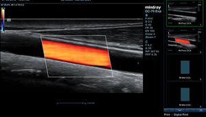 Sistema de escaneo de ultrasonido Doppler a color 4D de alto rendimiento <span class=keywords><strong>Mindray</strong></span> 21,5 X-insight con pantalla de pulgadas para uso animal - Product Image 6