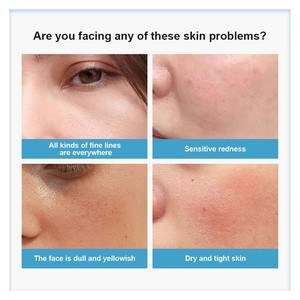Crème hydratante Safe <span class=keywords><strong>Derma</strong></span> 24X apaisante avec D-Panthenol, probiotiques, bêta-sitostérol, hydratation longue durée, protection de la barrière cutanée - Product Image 6