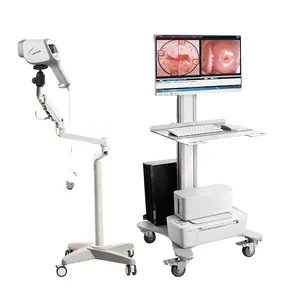 Krachtige High Definition 2.1 Mp Camera En Beeldvormingsmodule Gynaecologische Digitale Video Colposcoop Systeem Voor Vrouwen Gezondheid