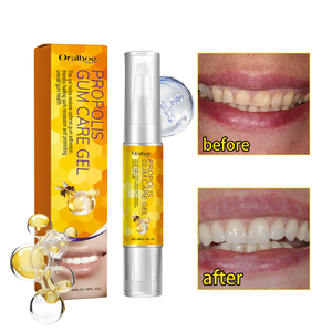 Gel de soin des gencives à la propolis Solution de soin <span class=keywords><strong>anti</strong></span>-<span class=keywords><strong>tartre</strong></span> blanchissant pour les dents - Product Image 4