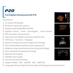 Équipement d'échographie vétérinaire de haute qualité et haute résolution pour animaux de compagnie, pour les cliniques vétérinaires (version d'exportation anglaise) - Product Image 1