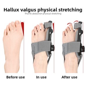 Corrector <span class=keywords><strong>de</strong></span> Hallux Valgus Ajustable para Día y Noche, Material PP, Talla Única, Soporte para <span class=keywords><strong>Dedos</strong></span> con Ajuste <span class=keywords><strong>de</strong></span> Perilla, Protector <span class=keywords><strong>de</strong></span> <span class=keywords><strong>Dedos</strong></span>, <span class=keywords><strong>Separador</strong></span> <span class=keywords><strong>de</strong></span> <span class=keywords><strong>Dedos</strong></span> - Product Image 3
