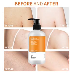 Crème hydratante pour la peau noire féminine avec logo personnalisé, lissante, hydratante, blanchissante, à l'acide kojique, lotion pour le corps - Product Image 4