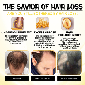OUHOE Aceite Esencial de Jengibre PARA EL Cuidado del Cabello, Suave y Nutritivo, Raíz del Cabello, Aceite Esencial para Masaje del Cuero Cabelludo