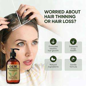 Champú de Romero para el Crecimiento del Cabello, Anticaspa, Cuidado del Cuero Cabelludo, Ingredientes Naturales, OEM/ODM Disponible para Todo Tipo de Cabello - Product Image 4