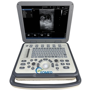 Мощный Ветеринарный ультразвуковой аппарат для диагностики живота, сердца и сосудов, многовучевой синтез, доплеровский CU50 - Product Image 1