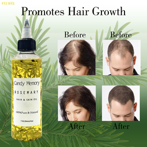 Olio di Rosmarino per Capelli e Pelle 118ML Marchio Privato 100% Puro Naturale Pressato a Freddo per la Crescita dei Capelli delle Donne di Colore - Product Image 2