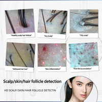 Analyseur de cuir chevelu sans fil professionnel 50X & 200X HD, détecteur de follicules pileux, microscope portable pour analyse des follicules, masseur